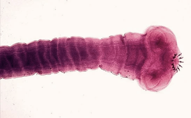 Tapeworm Head